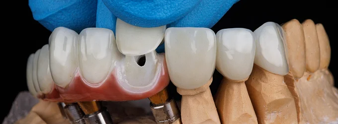 Cosmetic & Aesthetic Dentistry